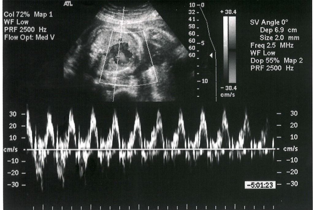 Fake Ultrasound Image