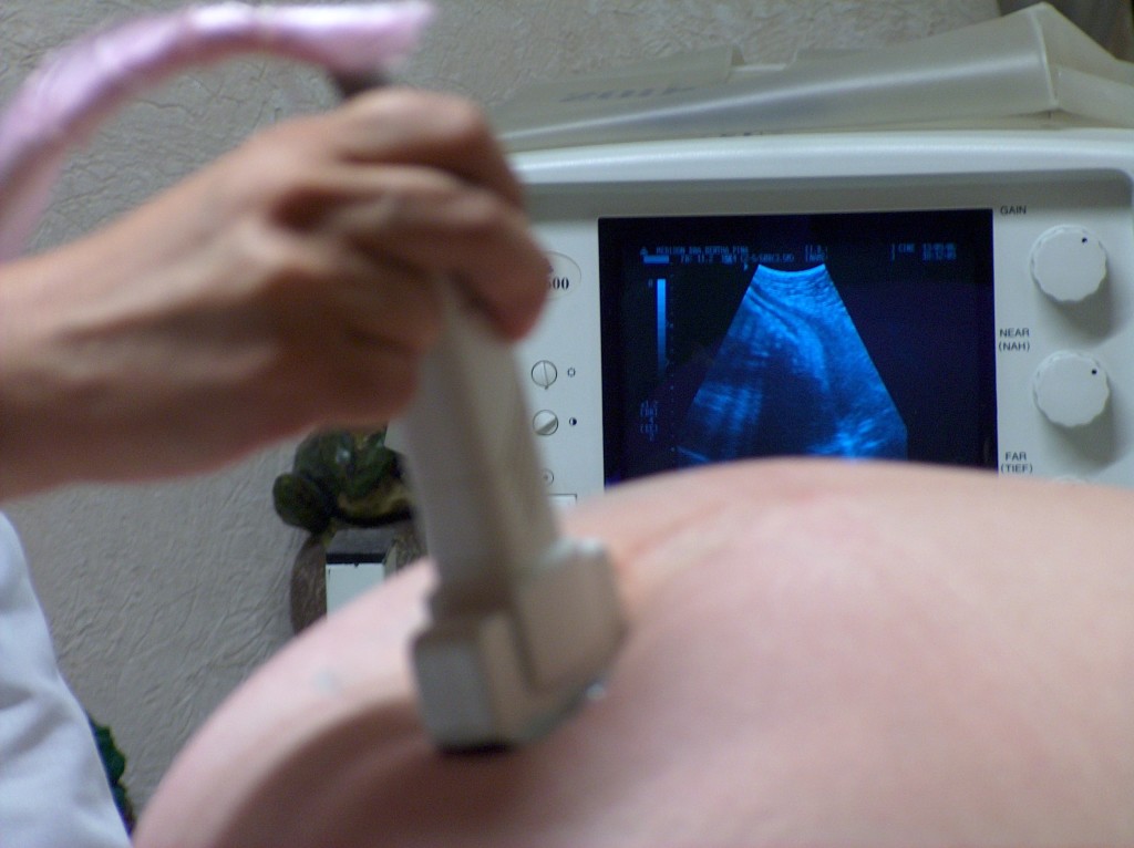 prank ultrasound picture